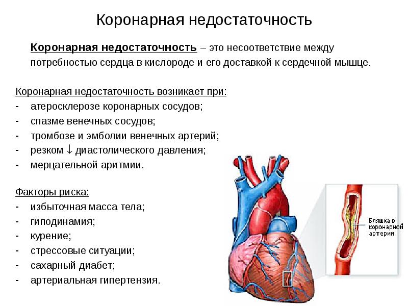 Варикозное Расширение Сердца