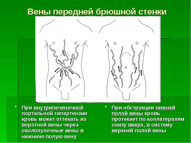 Варикоз Брюшной Полости Цена