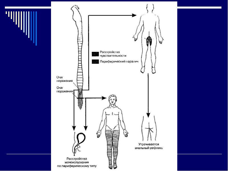 Вибратор Для Мужчин С Нарушением Чувствительности