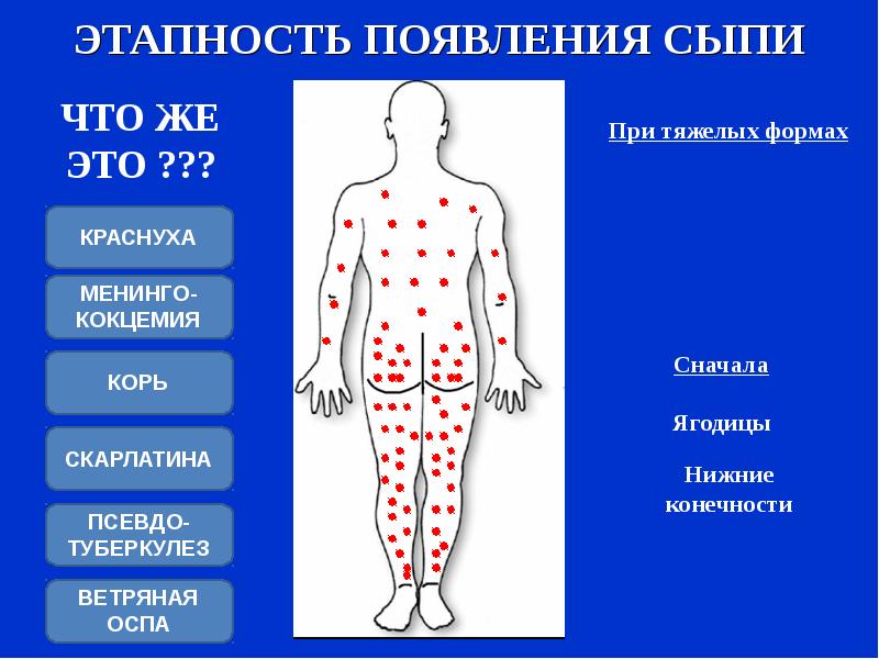 Фото Сыпи С Названием Болезни
