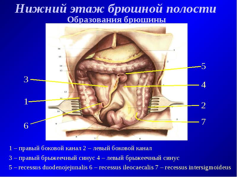 Варикоз Органов Брюшной Полости