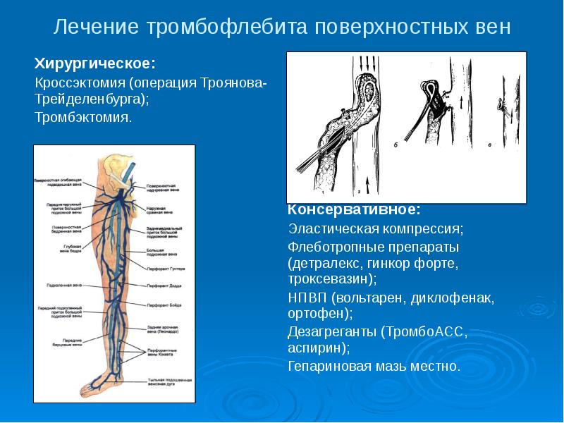 Вены На Ногах Диагноз