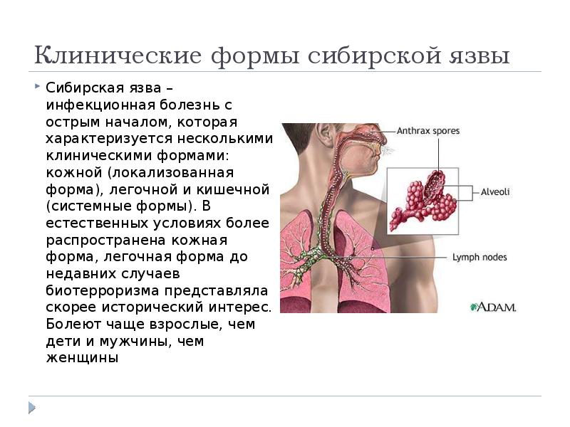 Кожная Форма Сибирской Язвы Фото