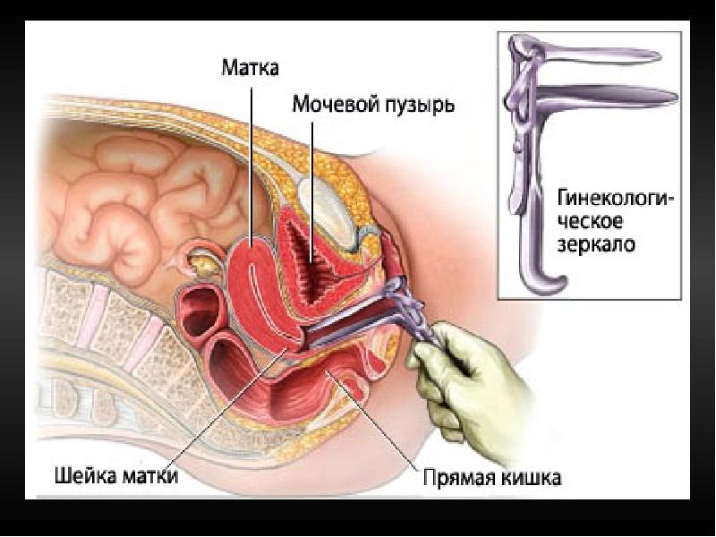 При Осмотре Гинеколог Может Определить Девственница