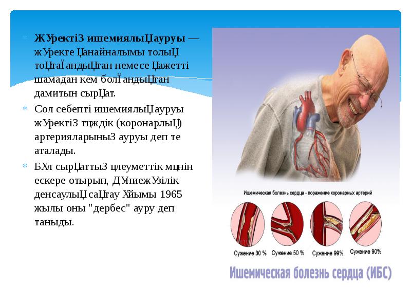 Варикоз Ауруы Туралы Эссе