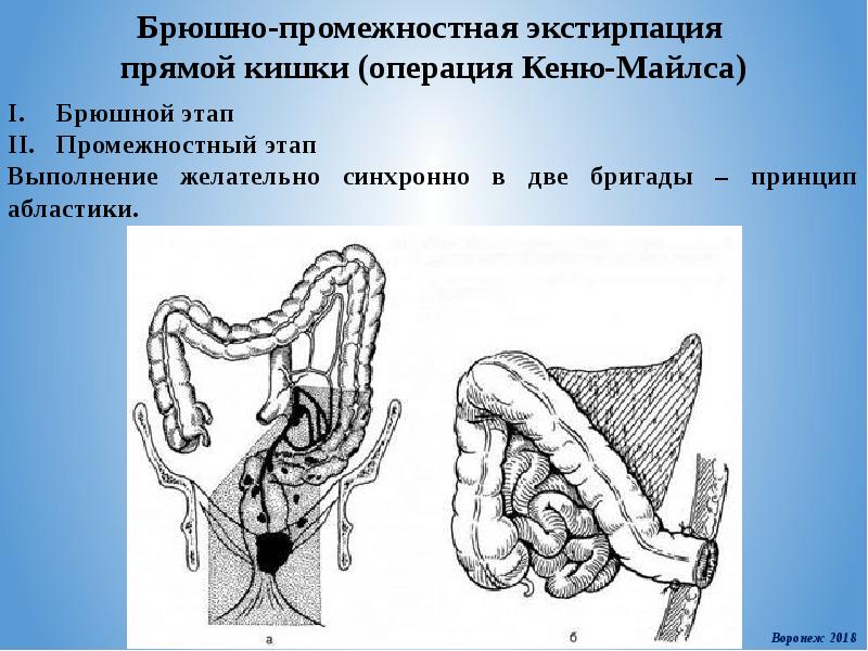 Piss in rectum