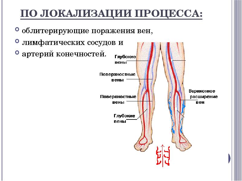 Вены На Ногах Диагноз