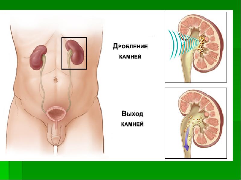 Последствия После Секса