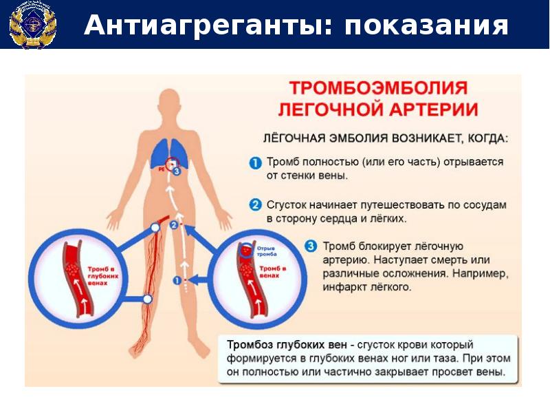 Варикозная Болезнь Карта Вызова