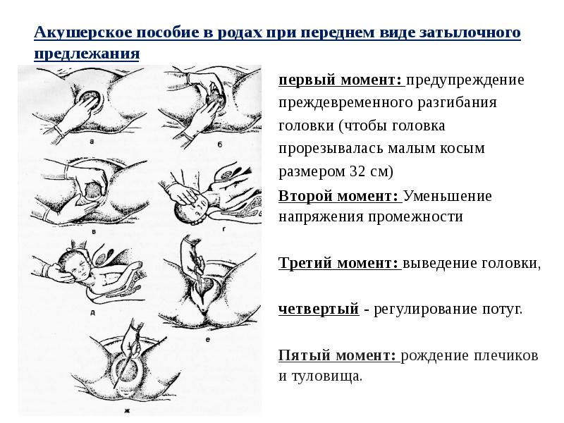 Можно Ли Заниматься Сексом После Кесарева Сечения