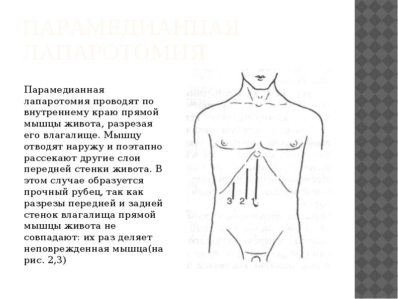 Режет Живот После Секса