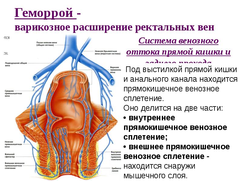 Варикозное Расширение Вен Геморрой