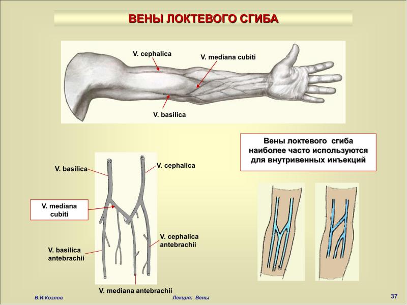 Вены Цефалика И Базилика