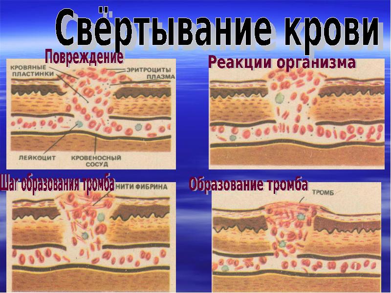 Свертывание крови картинка