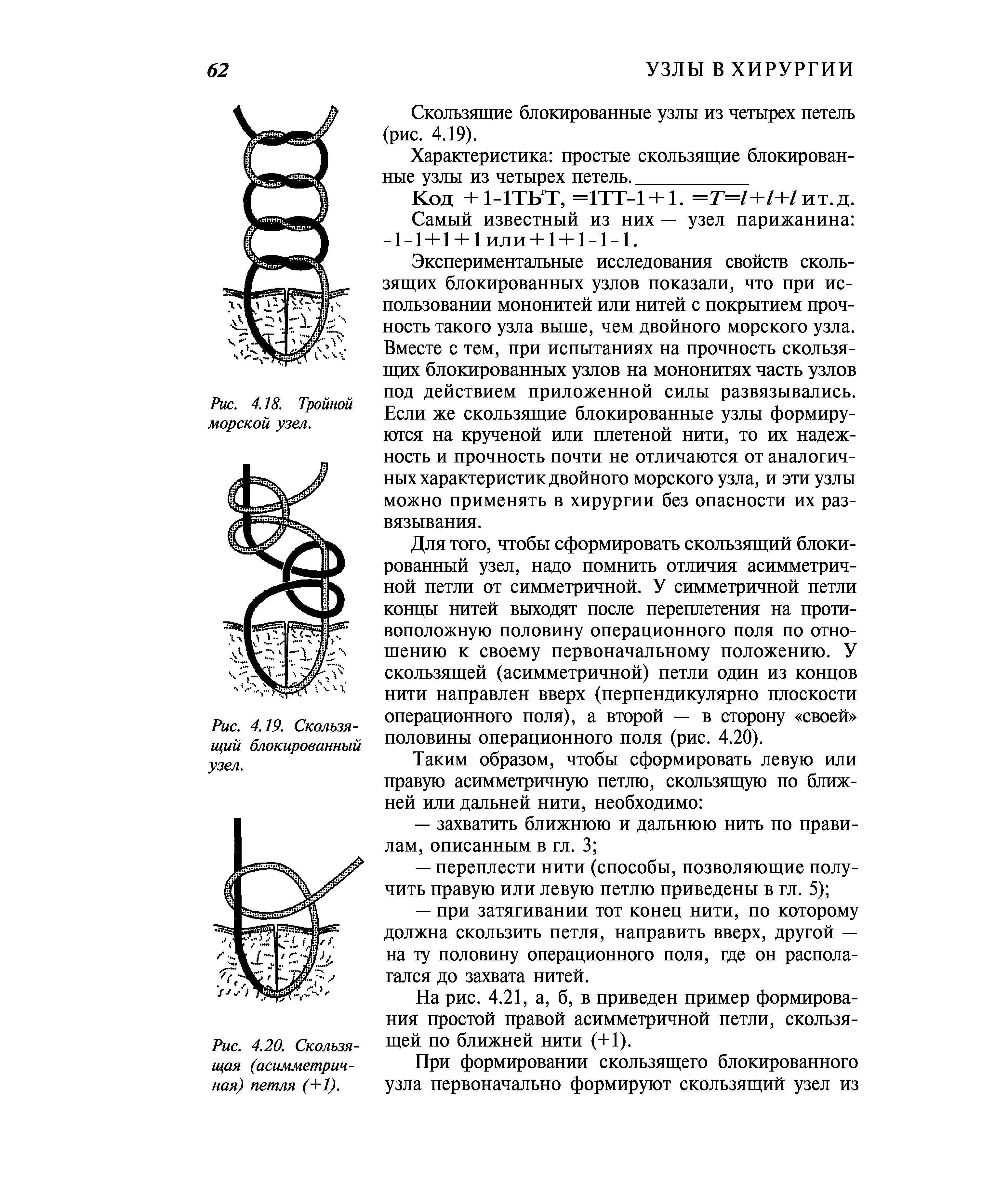 Схема хирургического узла