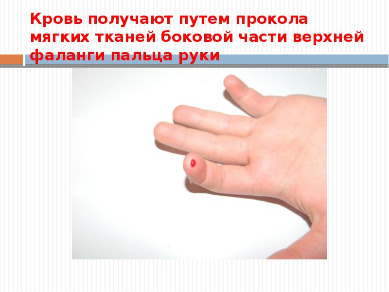 фаланга пальца. верхняя фаланга пальца. фаланга пальца. верхняя фаланга пальца. фаланга пальца.