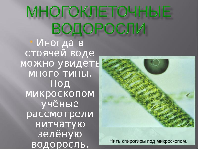 Водоросли в стоячей воде. Рассмотрите под микроскопом нитчатую водоросль. Нитчатые зеленые водоросли. Нитчатые водоросли под микроскопом. Многоклеточная зеленая водоросль по микроскопом.