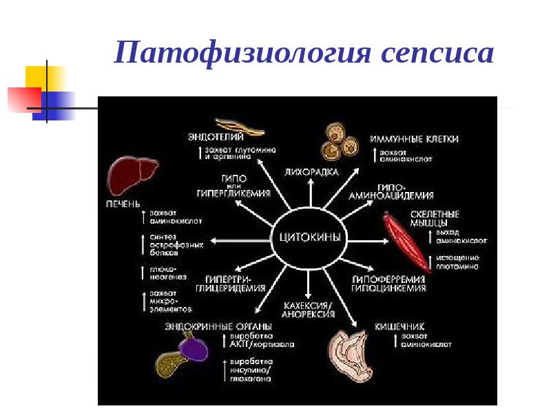 Схема иммунопатогенеза сепсиса