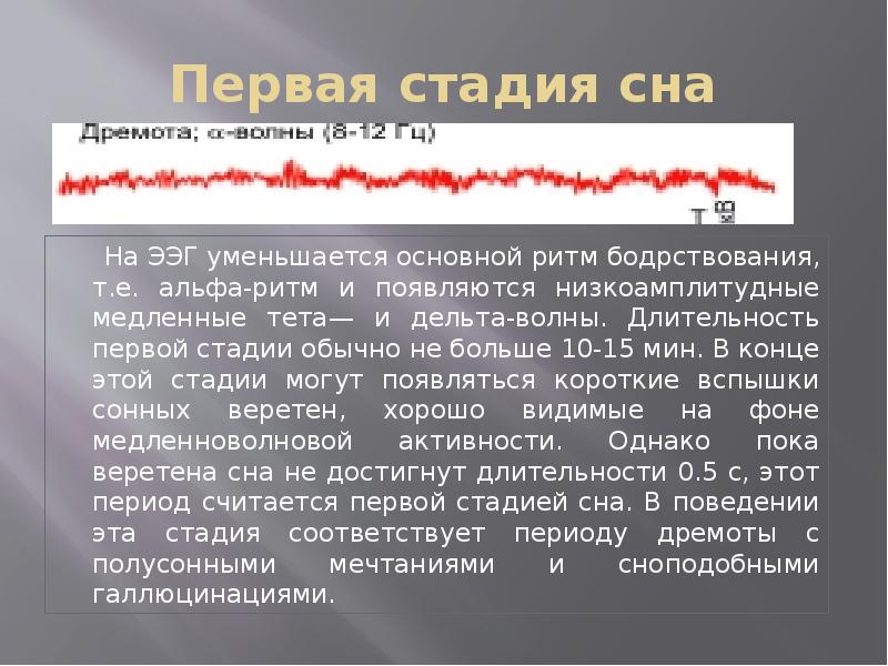 Фаза сна текст. Первая стадия медленного сна. ЭЭГ медленного сна. Первая стадия сна на ЭЭГ. Фазы и стадии сна физиология.