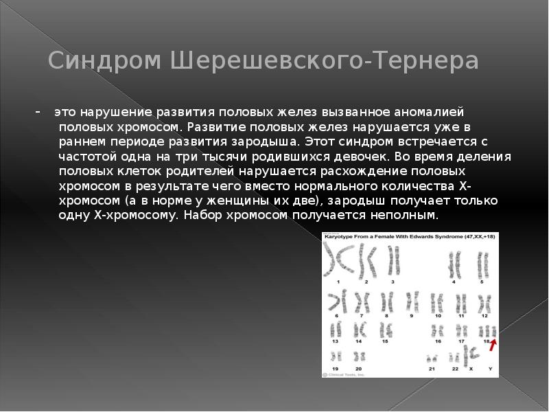 Синдром Шерешевского Тернера. Синдром Шерешевского Тернера презентация. Синдром Дауна Клайнфельтера Шерешевского.