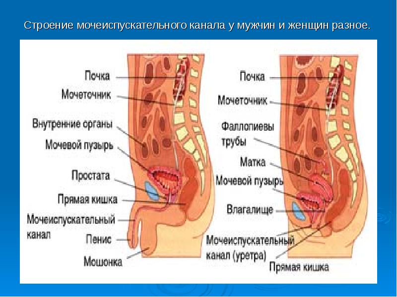 Полип мочеиспускательного канала у женщин фото