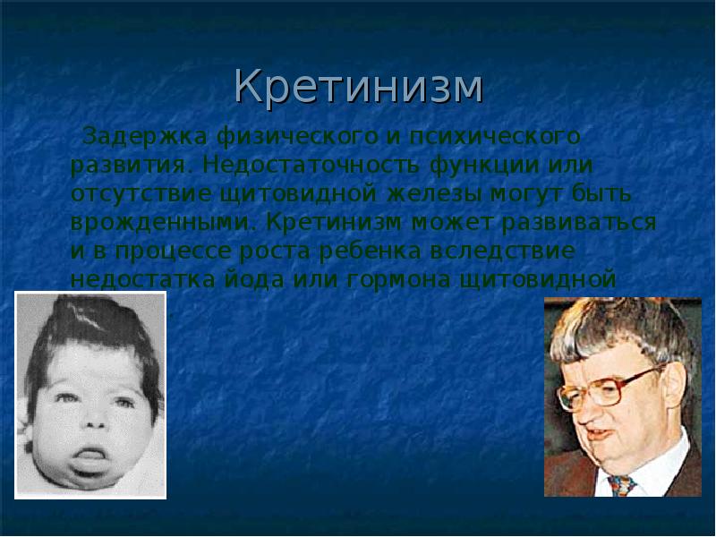 Кретинизм это. Отставание в физическом развитии. Кретинизм развивается при. Врожденная недостаточность (кретинизм).