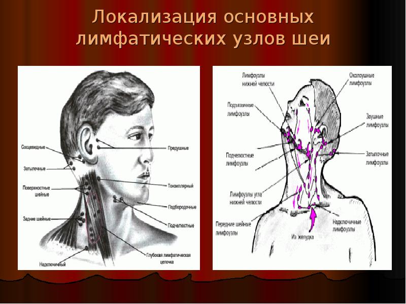 Локализация основных лимфатических узлов шеи