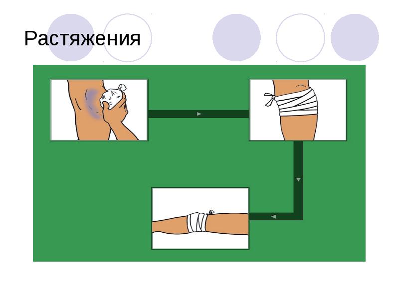 Действия при травмах 3 класс обж презентация