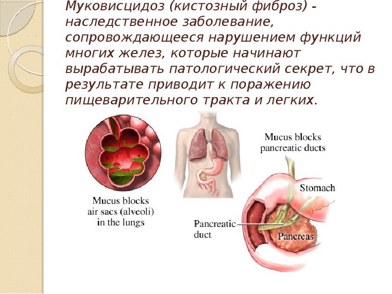 Муковисцидоз презентация генетика