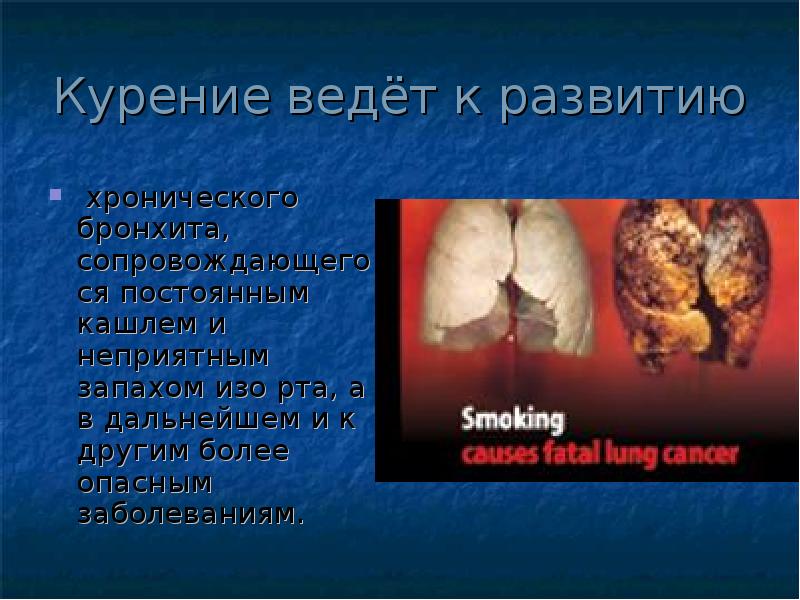 Курение ведёт к развитию
хронического бронхита, сопровождающегося постоянным кашлем и Курение ведёт к развитию
хронического бронхита, сопровождающегося постоянным кашлем и