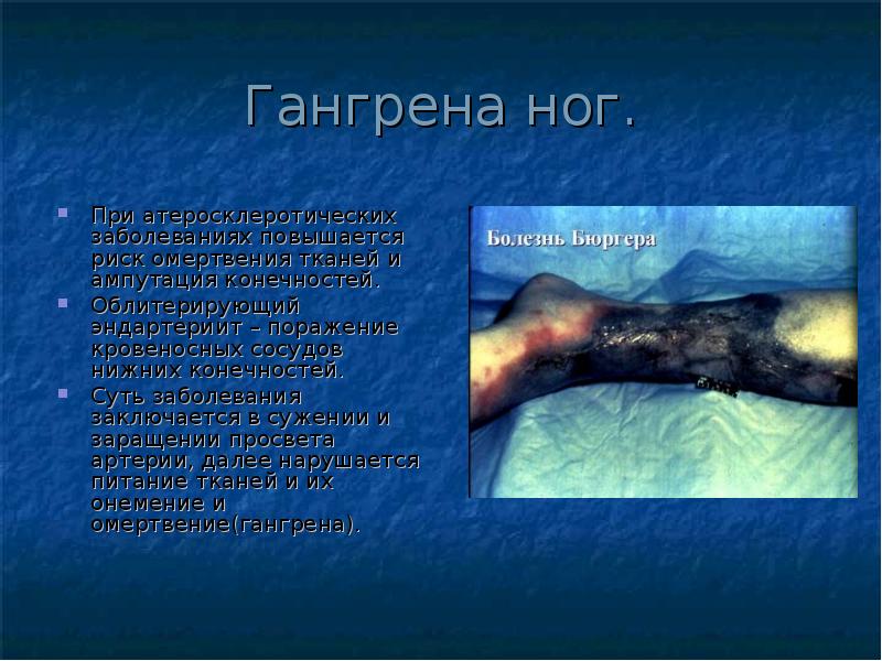 Гангрена ног.
При атеросклеротических заболеваниях повышается риск омертвения тканей и ампутация Гангрена ног.
При атеросклеротических заболеваниях повышается риск омертвения тканей и ампутация