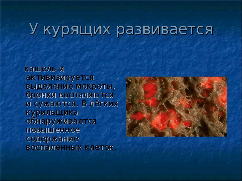 У курящих развивается
кашель и активизируется выделение мокроты, бронхи У курящих развивается
кашель и активизируется выделение мокроты, бронхи