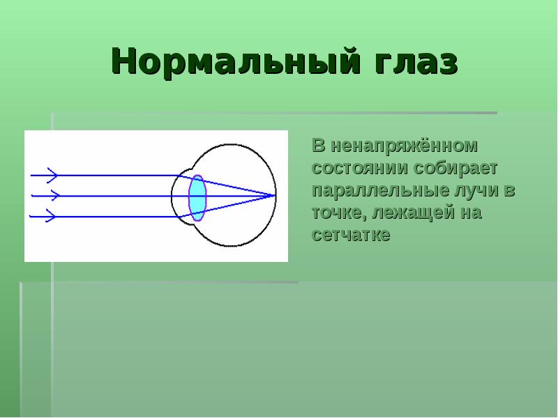 Глаз и зрение близорукость и дальнозоркость физика 8 класс презентация