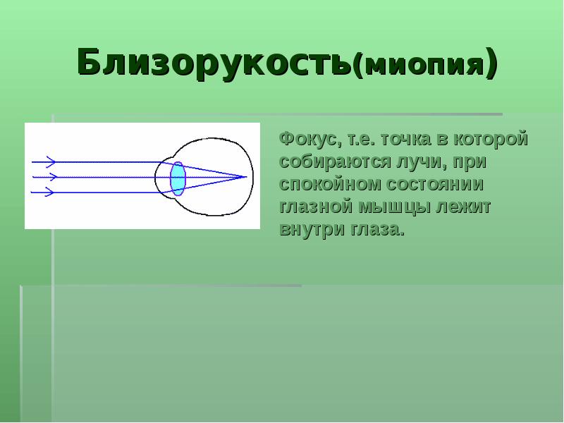 Близорукость презентация физика