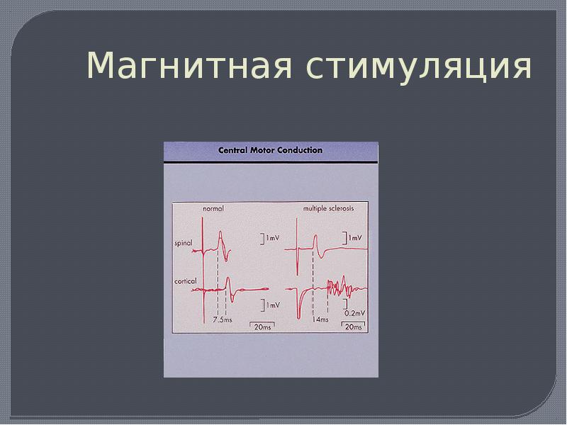 Магнитная стимуляция. Никитин магнитная стимуляция. Conduction Motors.