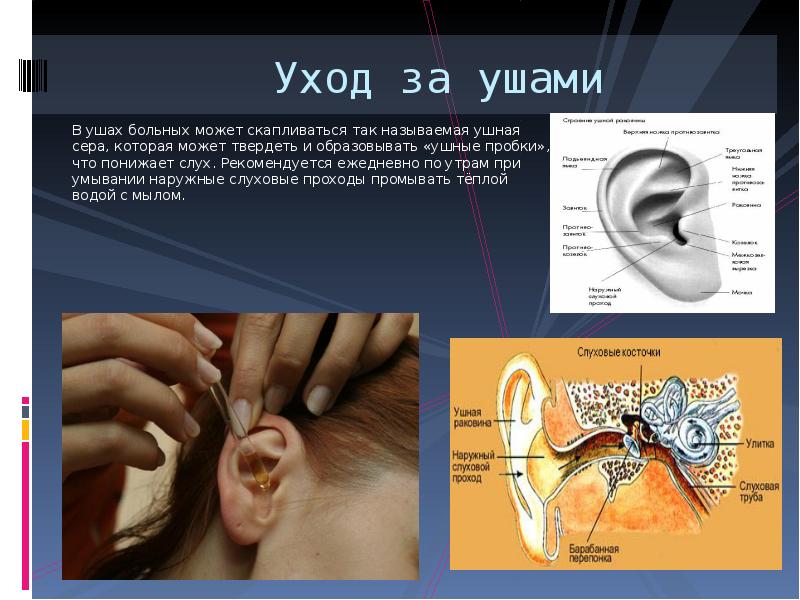 Уход за ушами В ушах больных может скапливаться так называемая ушная