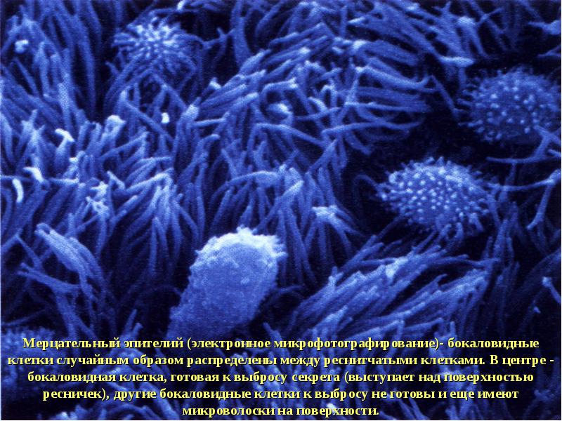 Мерцательный эпителий (электронное микрофотографирование)- бокаловидные клетки случайным образом распределены между реснитчатыми