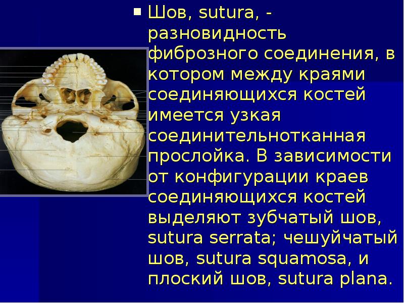 Артрология анатомия презентация