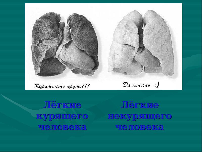 Легкие курящего человека картинки для детей