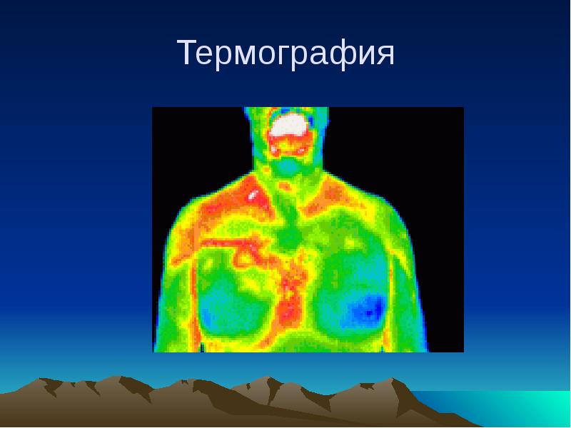 Термография. Медицинская термография. Термография опухоли. Термография слайд. Термография в онкологии.