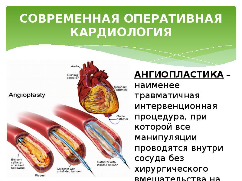 Презентация на тему ссз