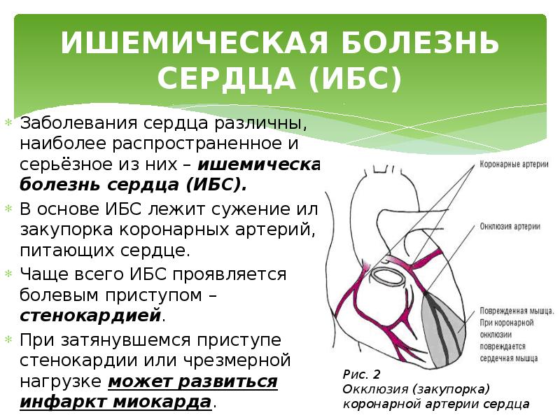 Болезни сердца список. Ишемическая болезнь сердца симптомы профилактика. Ишемическая болезнь сердца (ИБС) — заболевание. Ишемическая болезнь сердца презентация. Презентация на тему заболевания сердца.