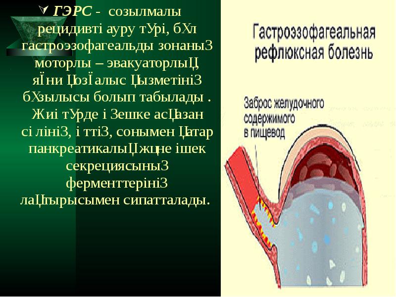 Созылмалы холецистит презентация