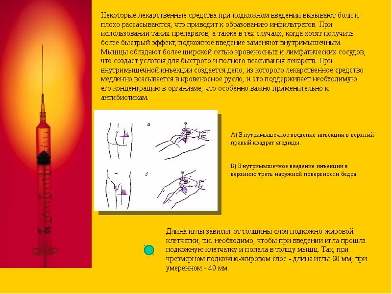 Подкожное введение лекарственных средств презентация