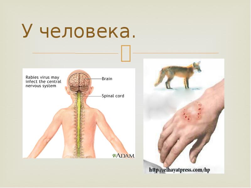 Рабдовирусы микробиология презентация