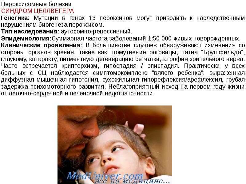 Синдром вялого ребенка. Пероксисомные болезни. Наследственные заболевания человека.