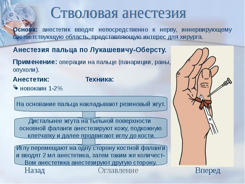 Обезболивание хирургия презентация