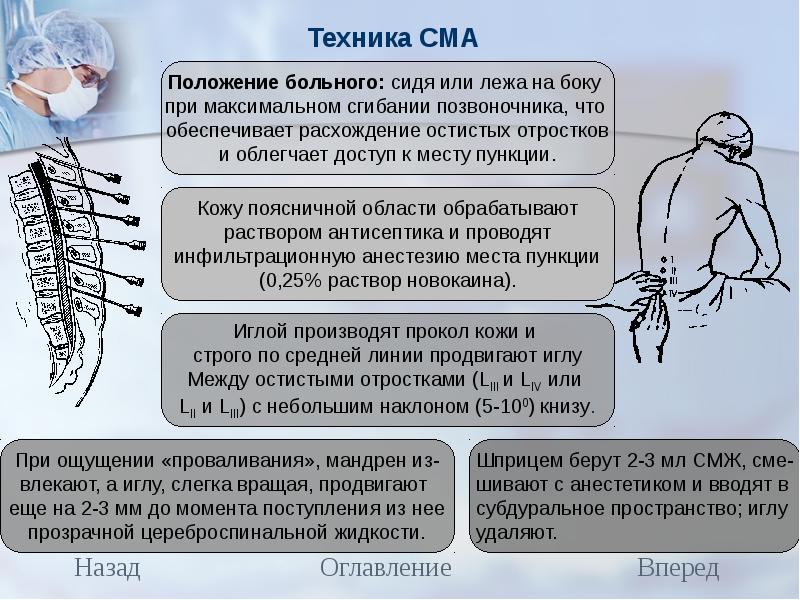 Спинально мышечная атрофия симптомы. СМА спинальная анестезия. Спинальнт мышечныеатрофии. Спинальная мышечная атрофия. Спинанпльномышечная атрофия.