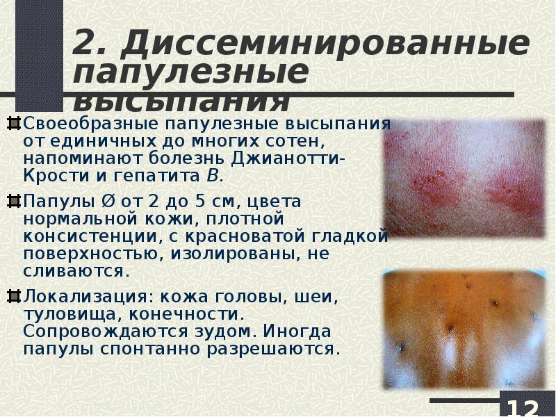 Фото кожных покровов вич инфицированных