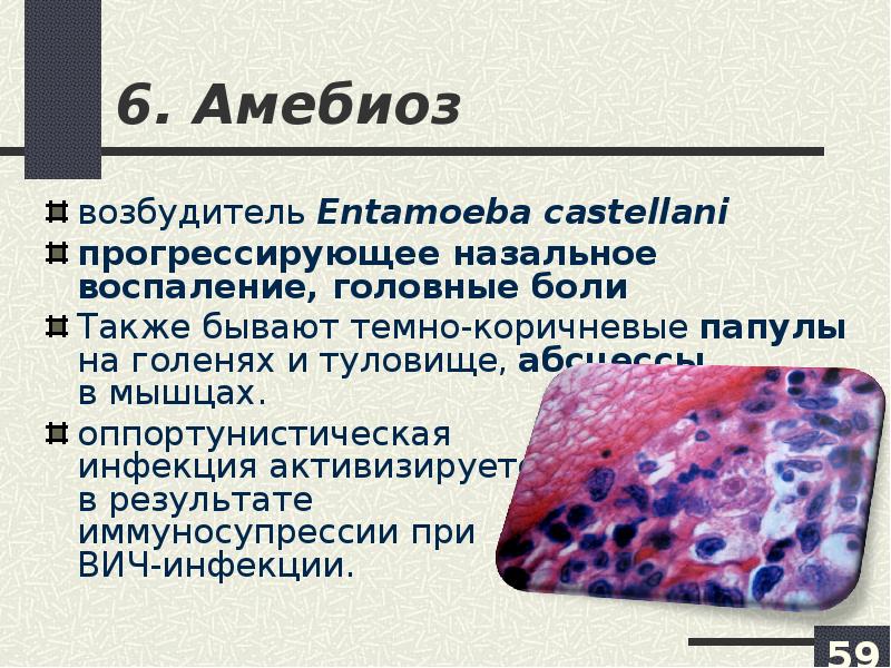 Амебиаз презентация казакша